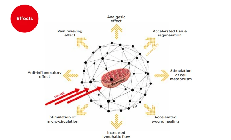 photobiomodulation